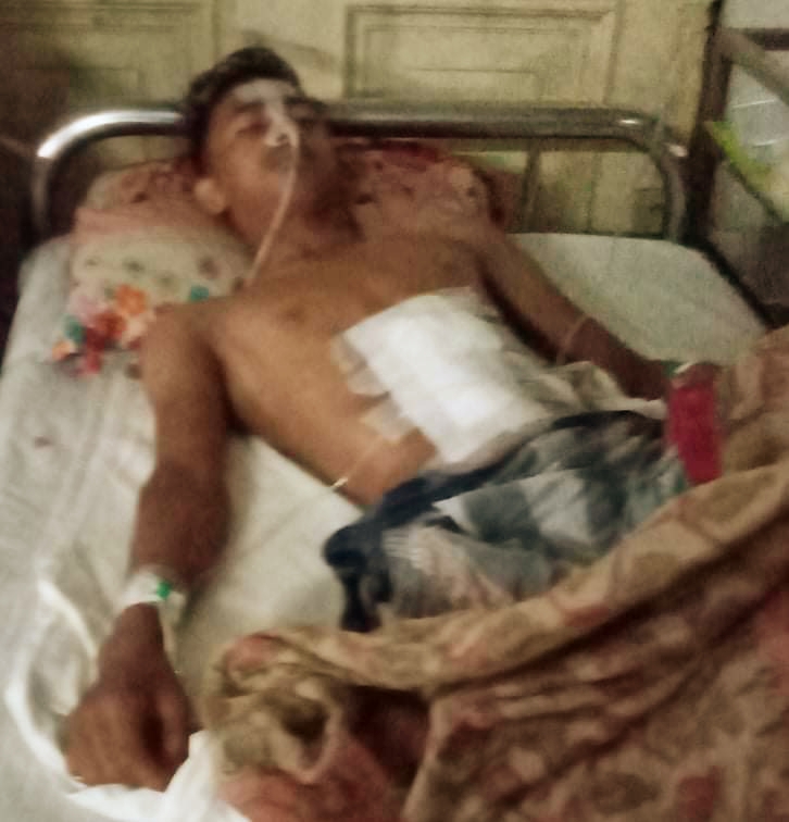 ব্রাহ্মণবাড়িয়ায় জায়গা নিয়ে বিরোধের জেরে প্রতিপক্ষের হামলায় ১ যুবক আহত
