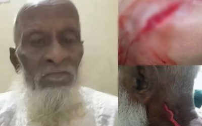 চুরি করার সময় হাতেনাতে আটক করায় বৃদ্ধ কে ছুরিকাঘাতে জখম! ঢাকা মেডিকেলে ভর্তি