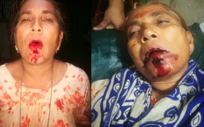 আখাউড়ায় অর্থ লেনদেনের জেরে শ্বশুরের লোকজনের হামলায় জামাই ও তার মা আহত