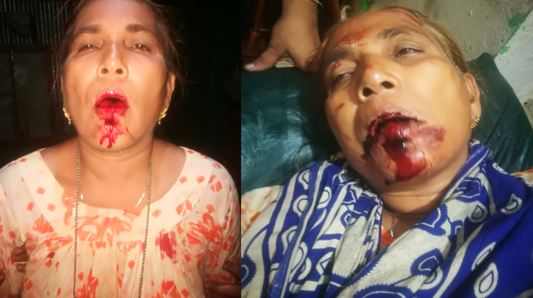 আখাউড়ায় অর্থ লেনদেনের জেরে শ্বশুরের লোকজনের হামলায় জামাই ও তার মা আহত