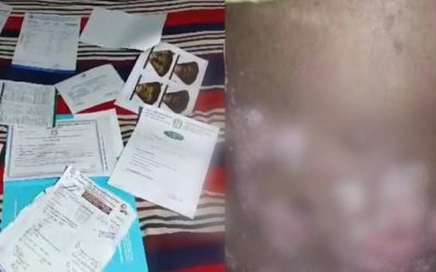 আখাউড়ায় দুরারোগ্যে আক্রান্ত কলেজ ছাত্রী রুবিনা বাঁচতে চায়