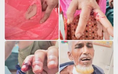 আখাউড়ায় জবরদখলে বাঁধা দেওয়ায় সাংবাদিক পরিবারে হামলা আহত ৫